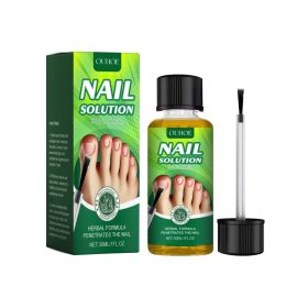 OUHOE Nail Care Solution, Gentle Repair, Clean, Nourish, Shine And Relieve Uncomfortable Nail Care Solution (Option: 30ml-46.2g-3.22*1.18*1.18inch)